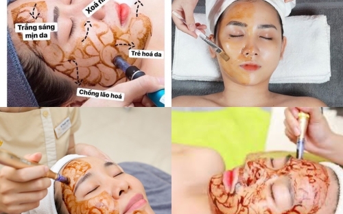 Cấy hồng sâm dưỡng da